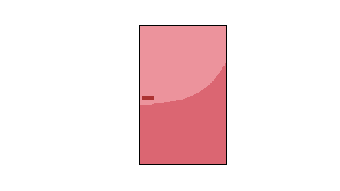 dfs